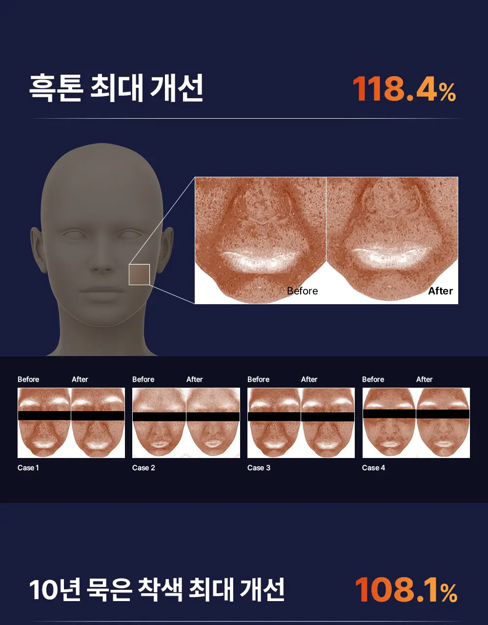 [순수비타민C/잡티앰플] 마미케어 오쏘타민 비타민C 앰플 15ml 상세페이지 26